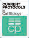 Standardized Cryopreservation of Human Primary Cells