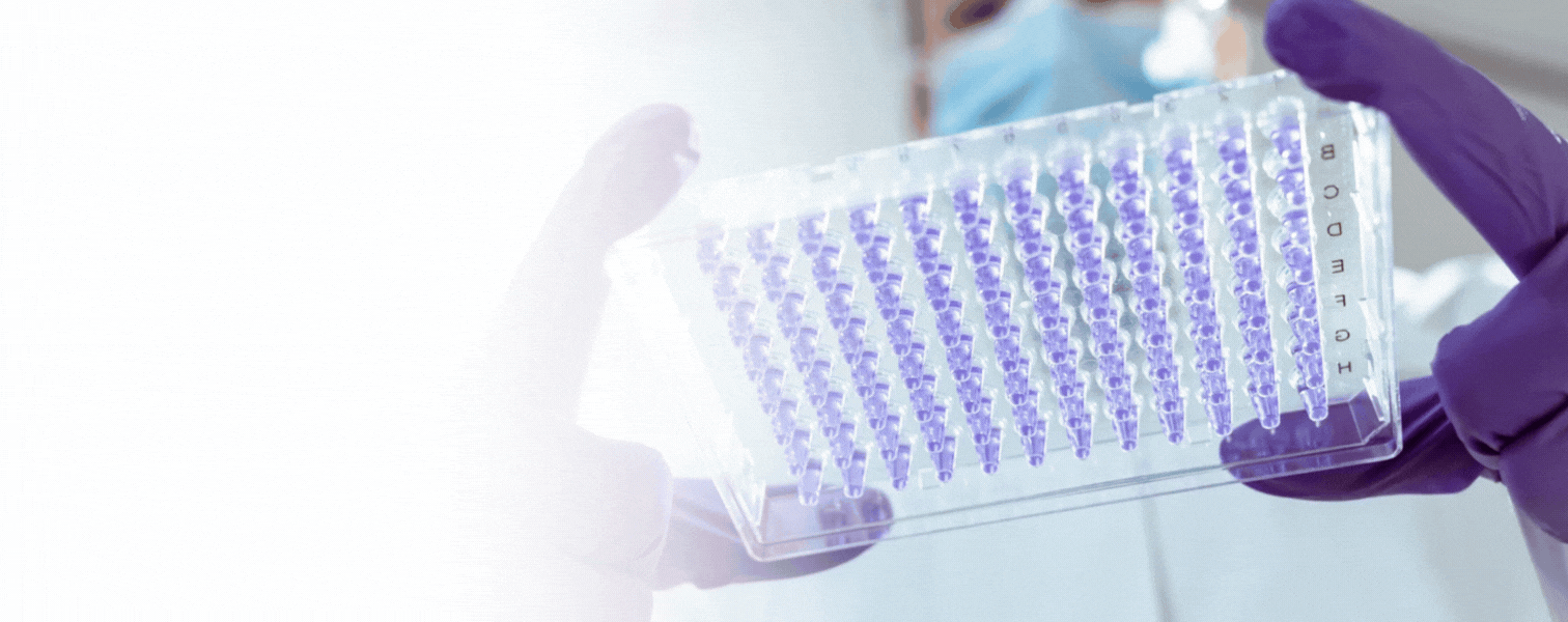 96 well microplate filled with reagent being inspected by lab technician